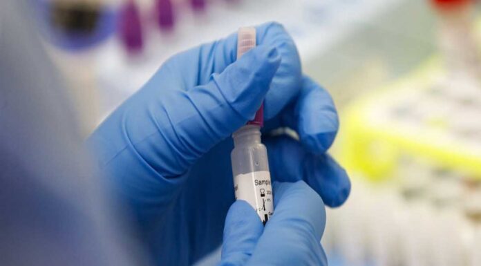 Ιαπωνία: Αντιικό φάρμακο για τον κορωνοϊό προκαλεί γενετικές ανωμαλίες Αντιικό φάρμακο για τον κορωνοϊό προκαλεί γενετικές ανωμαλίες