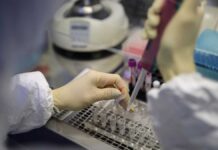Επιτροπή λοιμοξιολόγων: «Ο κορωνοϊός είναι μία γρίπη αλλά θα επιβάλλουμε τοπικά lockdown» Ο κορωνοϊός είναι μία γρίπη αλλά θα επιβάλλουμε τοπικά lockdown