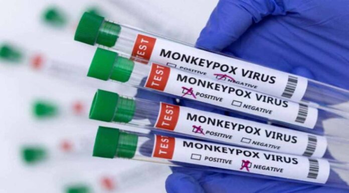 Καταγράφηκε και δεύτερο κρούσμα ευλογιάς των πιθήκων στην Ελλάδα – Ξεκινάει η εβδομαδιαία ενημέρωση και δεύτερο κρούσμα ευλογιάς των πιθήκων στην Ελλάδα