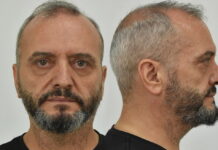 Βιασμός 12χρονης: Ένταλμα σύλληψης για τη μητέρα της 12χρονης στον Κολωνό