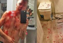 Αγγλία: Ήρωας πατέρας «κομματιάστηκε» από 5 βιαστές με ματσέτες και μαχαίρια αλλά έσωσε την 17χρονη κόρη του! (φώτο) (upd)