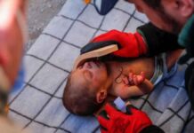 Σεισμός Τουρκία: Μωράκι 20 ημέρων σώθηκε μετά από 60 ώρες – Κρατούσε μία τούφα από τα μαλλιά της μητέρας του
