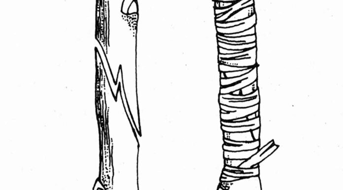 Aγγλικός επιτόπιος εγκεντρισμός