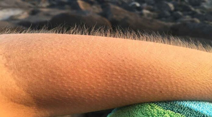 Επιστήμονες: Αν η μουσική σας ανατριχιάζει τότε ο εγκέφαλός σας είναι εξαιρετικός