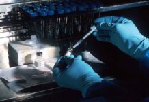 Αυτές είναι οι δέκα πιο παράξενες ασθένειες στην ιστορία της Ιατρικής