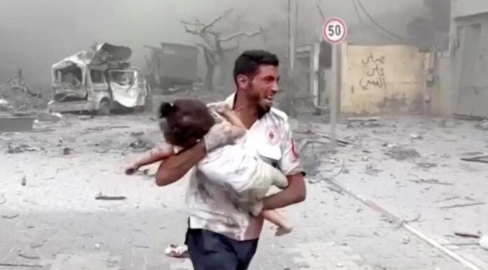 Η φωτογραφία της μέρας: γιατρός προσπαθεί να σώσει μωράκι στη Γάζα