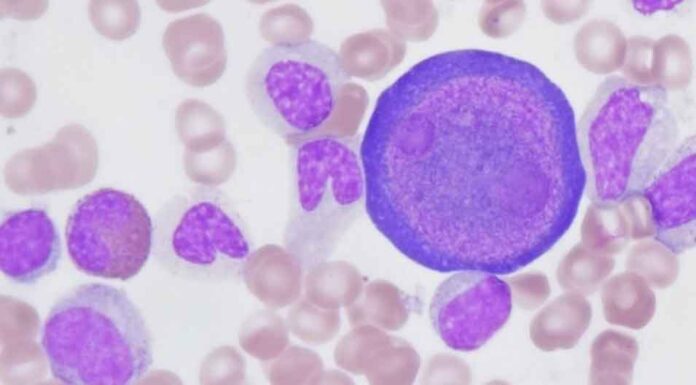 Παρβοϊός: Ποιο είναι το χαρακτηριστικό σύμπτωμα σύμφωνα με παιδίατρο – Τι λέει για τις εγκύους