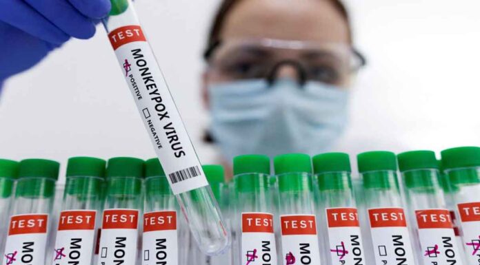 Ιός mpox, προσεχώς και στην Ελλάδα – Ποιοι πρέπει να προσέχουν διπλά