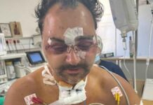 Στα χέρια της ΕΛ.ΑΣ οι δύο εκ των εμπλεκομένων στον άγριο ξυλοδαρμού του Ελληνοκαναδού