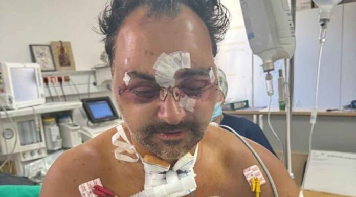 Στα χέρια της ΕΛ.ΑΣ οι δύο εκ των εμπλεκομένων στον άγριο ξυλοδαρμού του Ελληνοκαναδού